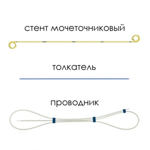 Мочеточниковый стент c покрытием Urotech Yellow Star