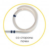 Мочеточниковый стент Urotech White Star