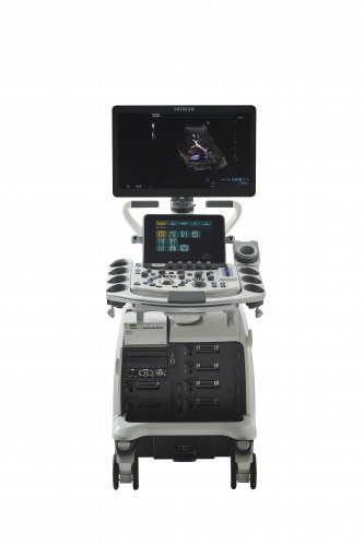 УЗИ аппарат стационарный Hitachi Arietta 850